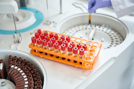 rack-of-blood-tubes-with-barcode-labels-with-centr-2023-11-27-05-24-06-utc